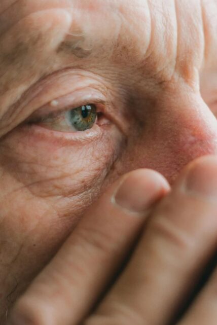 눈밑 떨림 증상으로 안면마비를 걱정하는 중장년층