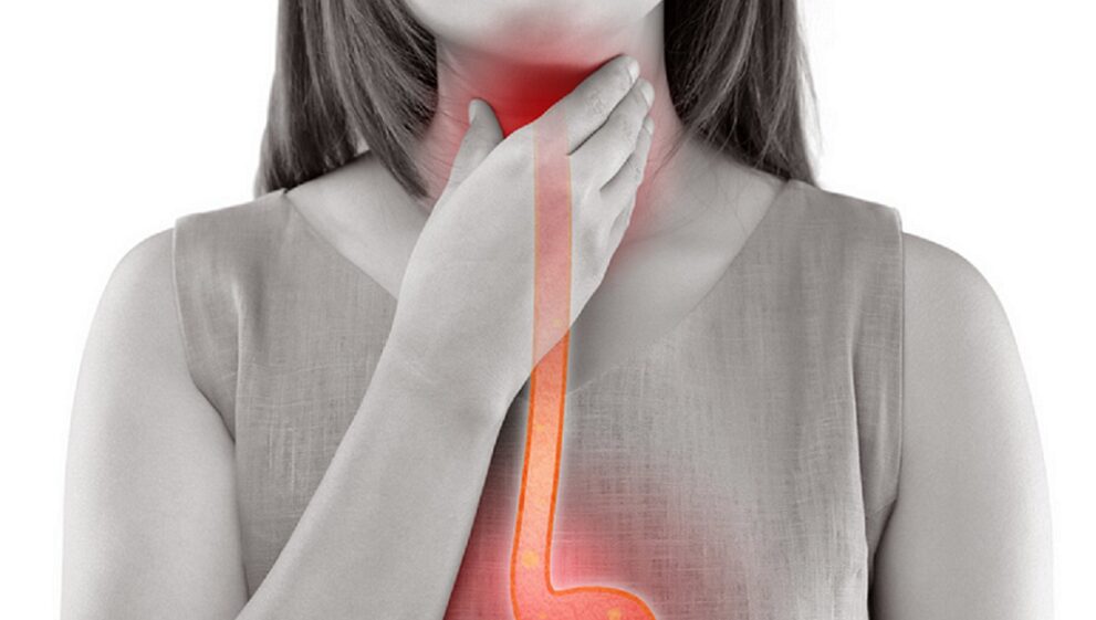 가슴 쓰림과 목 이물감을 느끼는 역류성 식도염 환자